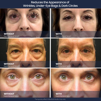 Rapid Renewal Serum