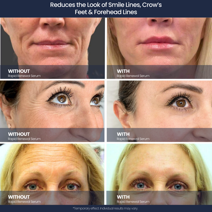Rapid Renewal Serum